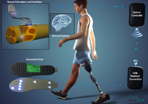 SensArs Neuroprosthetics – The Future of Nerve Stimulation