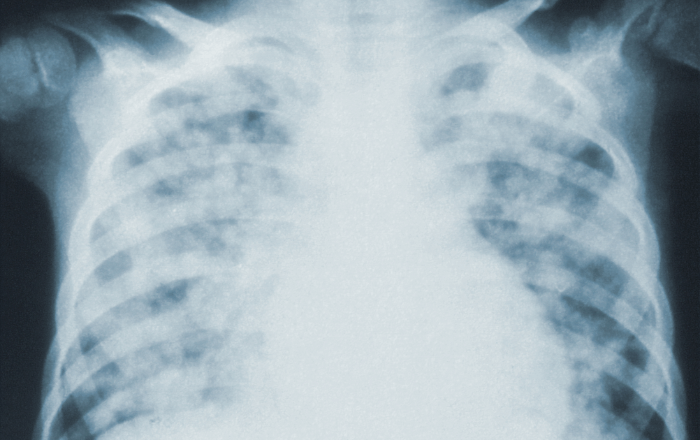 Master’s students developing ventilators