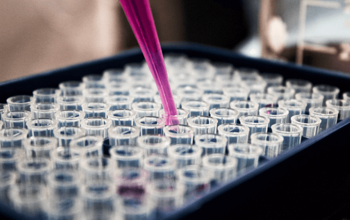 IrsiCaixa joins group to develop new vaccine